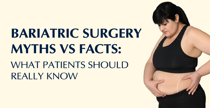 Bariatric Surgery Myths Vs Facts What Patients Should Really Know