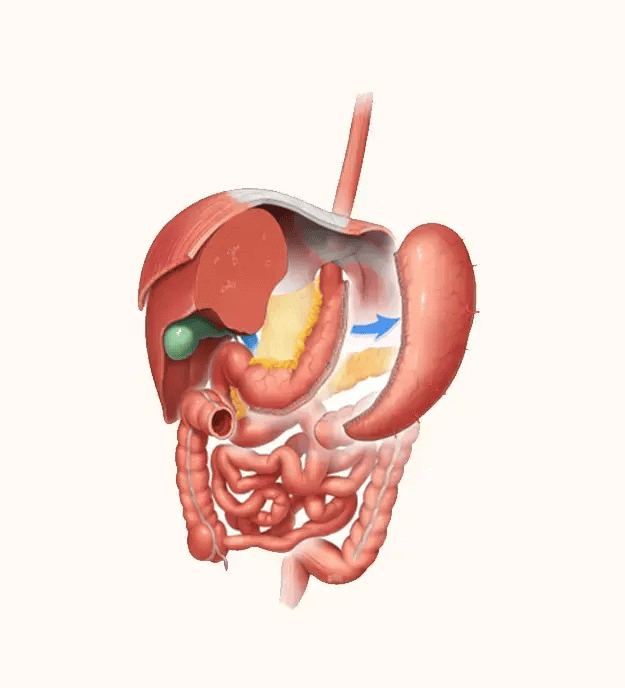 Gastric Sleeve Surgery Melbourne