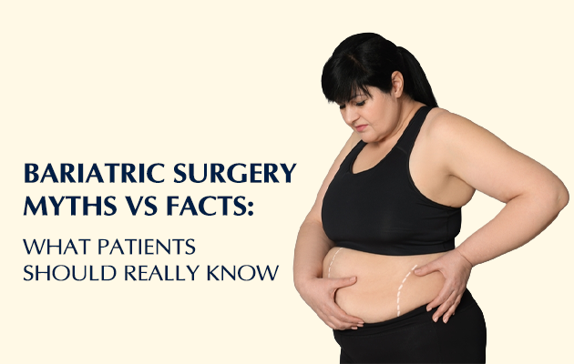 Bariatric Surgery Myths Vs Facts