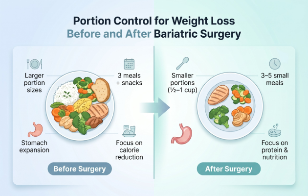 Portion Control For Weight Loss