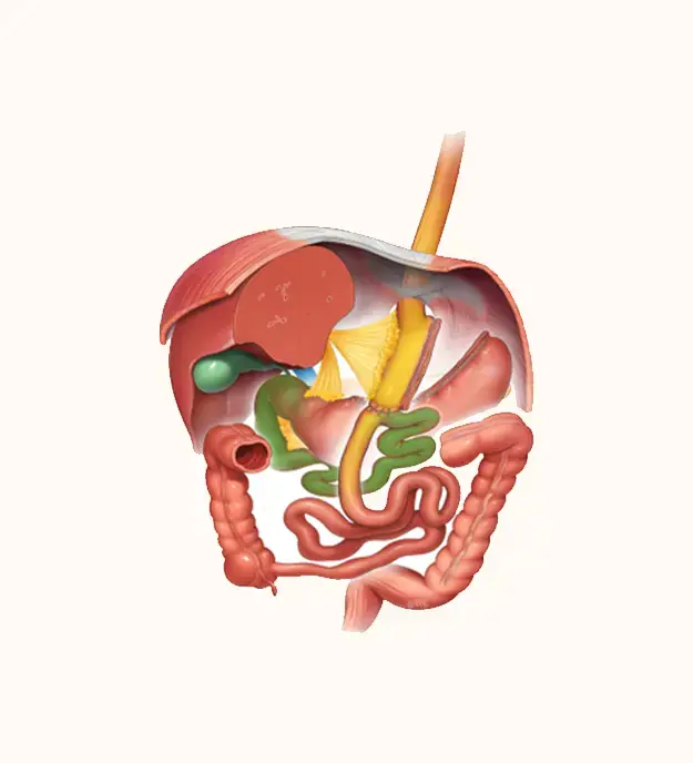 Mini Gastric Bypass Surgery