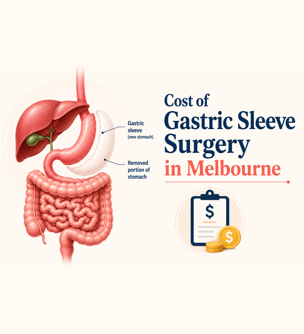 Cost Of Gastric Sleeve Surgery In Melbourne