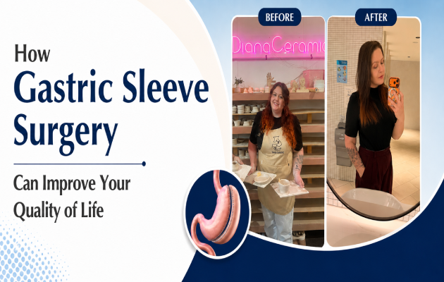 Gastric Sleeve Quality Of Life In Melbourne